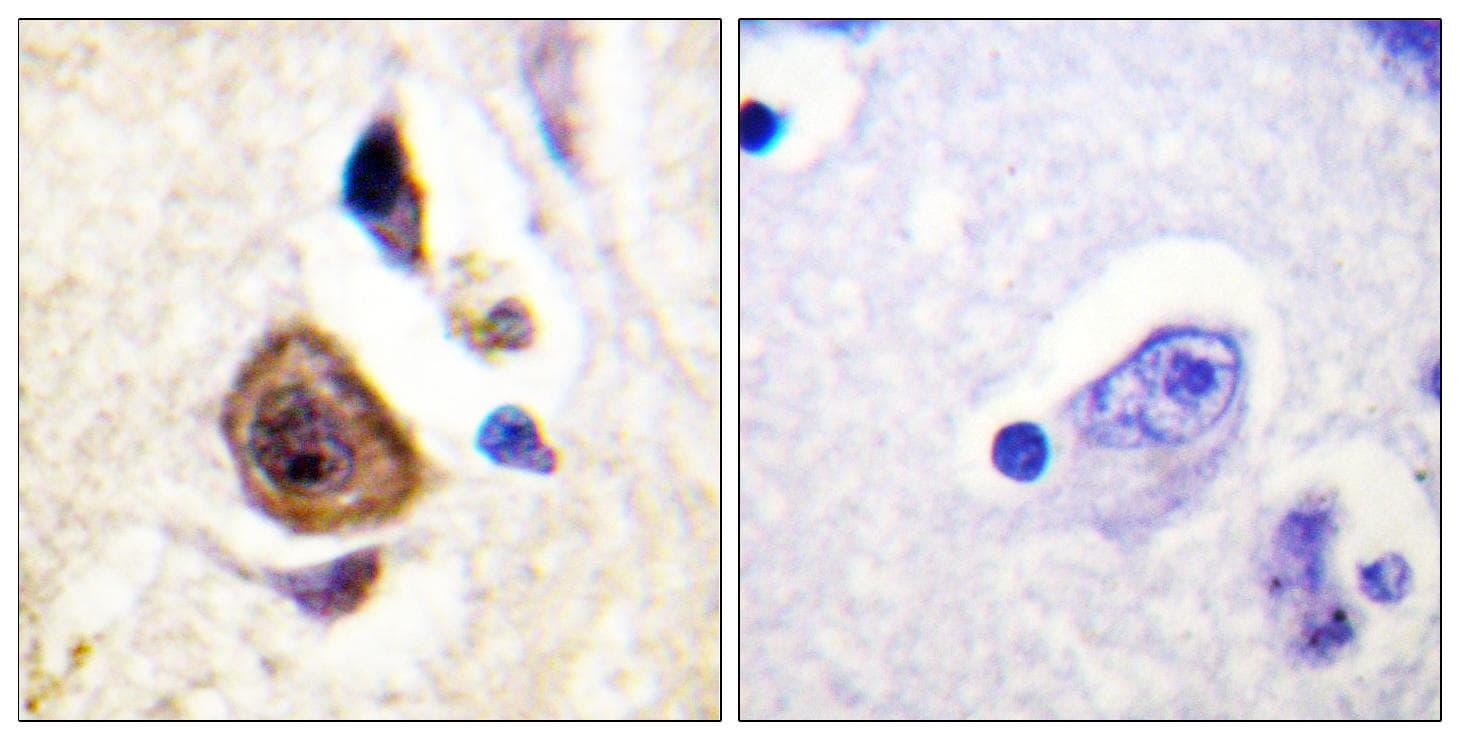 KCNC4 / Kv3.4 Antibody (p15)