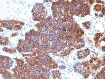 PTH / Parathyroid Hormone Antibody (C-Terminus, clone PTH/1174)