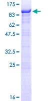 Human RIOK1 Protein (Recombinant GST)