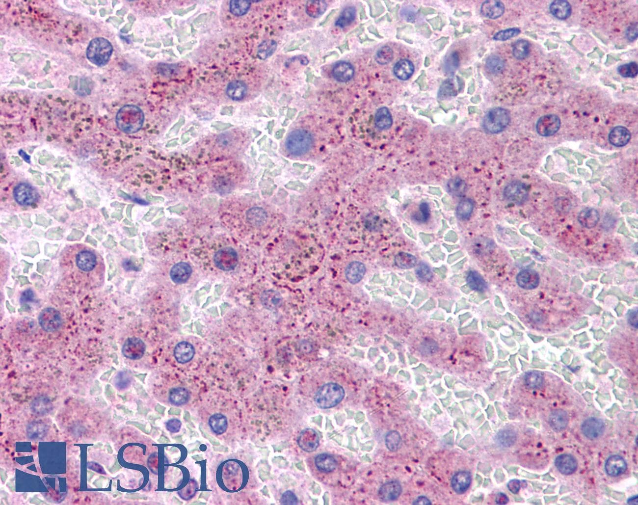 IHC-plus™ ACOT13 / THEM2 Antibody