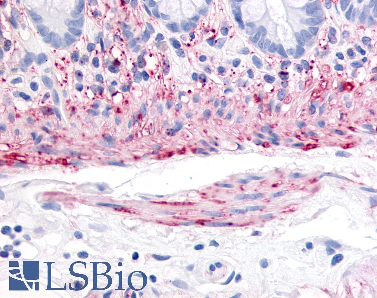 IHC-plus™ Polyclonal Rabbit anti-Human TACR2 / NK2R Antibody (Extracellular Domain, IHC)