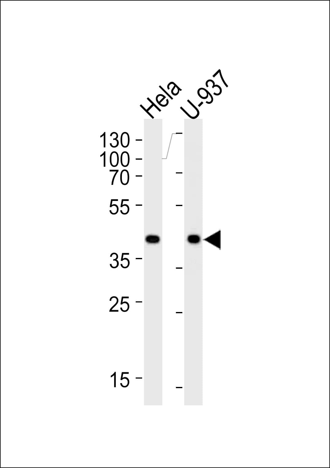 Polyclonal Rabbit anti-Human PGK1 / Phosphoglycerate Kinase Antibody (aa117-145, IHC, IF, WB)