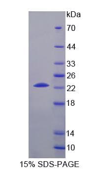 Mouse CHKB / CHKL Protein (Recombinant His, N-Terminal)