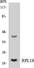 Polyclonal Rabbit anti-Human RPL18 / Ribosomal Protein L18 Antibody (aa102-151, WB)