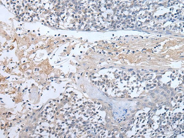 ABR Antibody