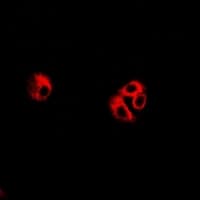 Polyclonal Rabbit anti-Human EIF3C / EIF3S8 Antibody (IF, WB)