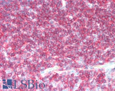 IHC-plus™ CD45 / LCA Antibody (clone F10-89-4)