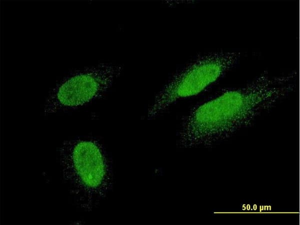 TTN / Titin Antibody (clone 6H5)
