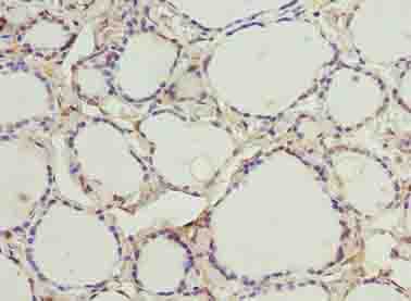 MTCP1NB Antibody
