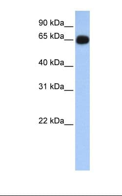 Polyclonal Rabbit anti-Human ALAS1 Antibody (aa146-195, IHC, WB)
