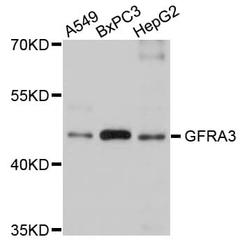 Polyclonal Rabbit anti-Human GFRA3 Antibody (WB)