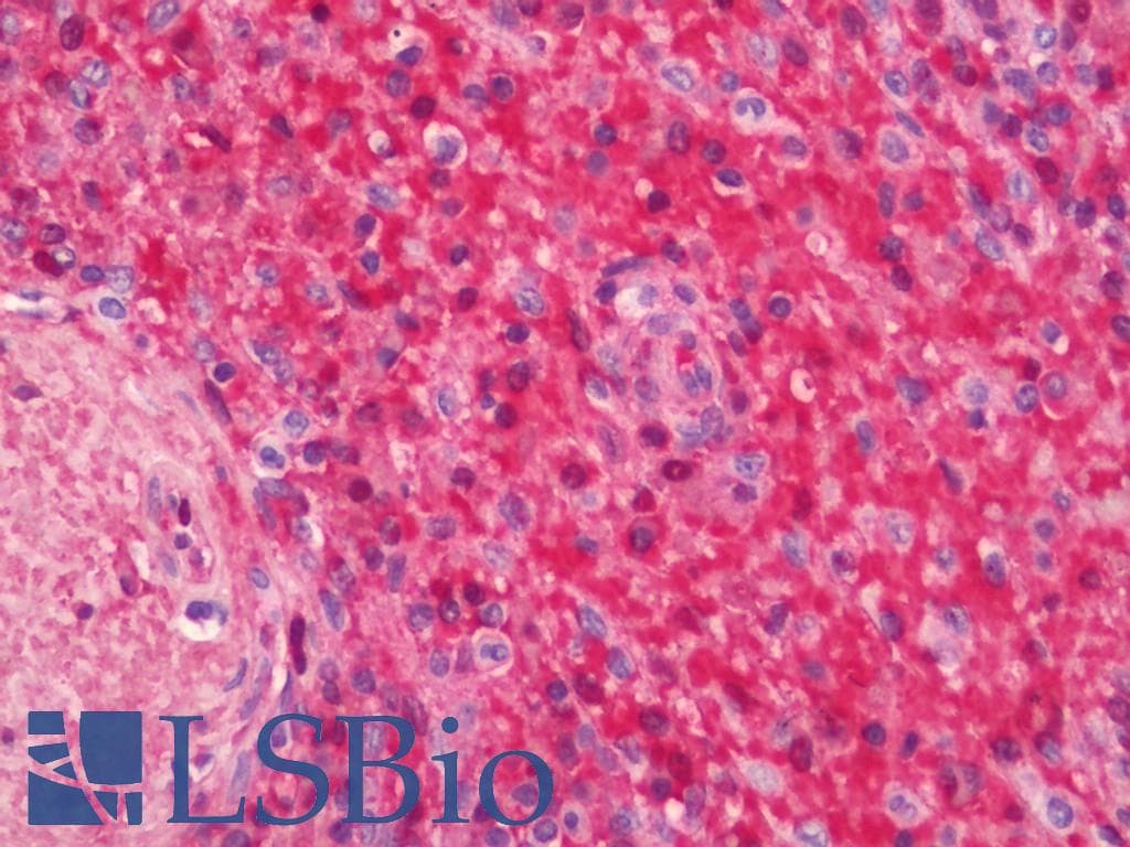 IHC-plus™ HBZ Antibody (clone 1G10)