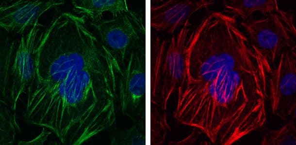 ACTA2 / Smooth Muscle Actin Antibody (clone 4A4)