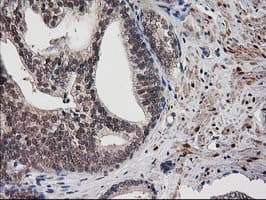 DSTN / Destrin Antibody (clone OTI1D8)
