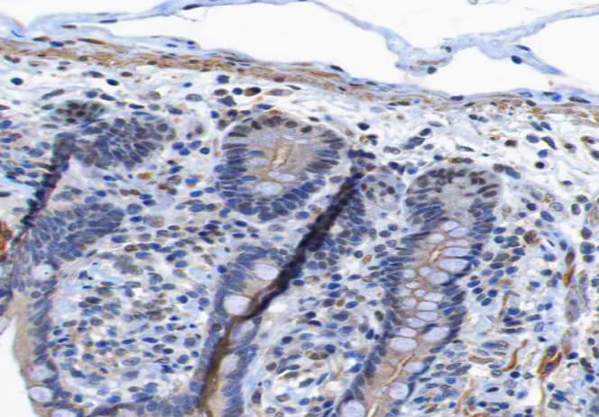 EGFR Antibody (phospho-Tyr1197)