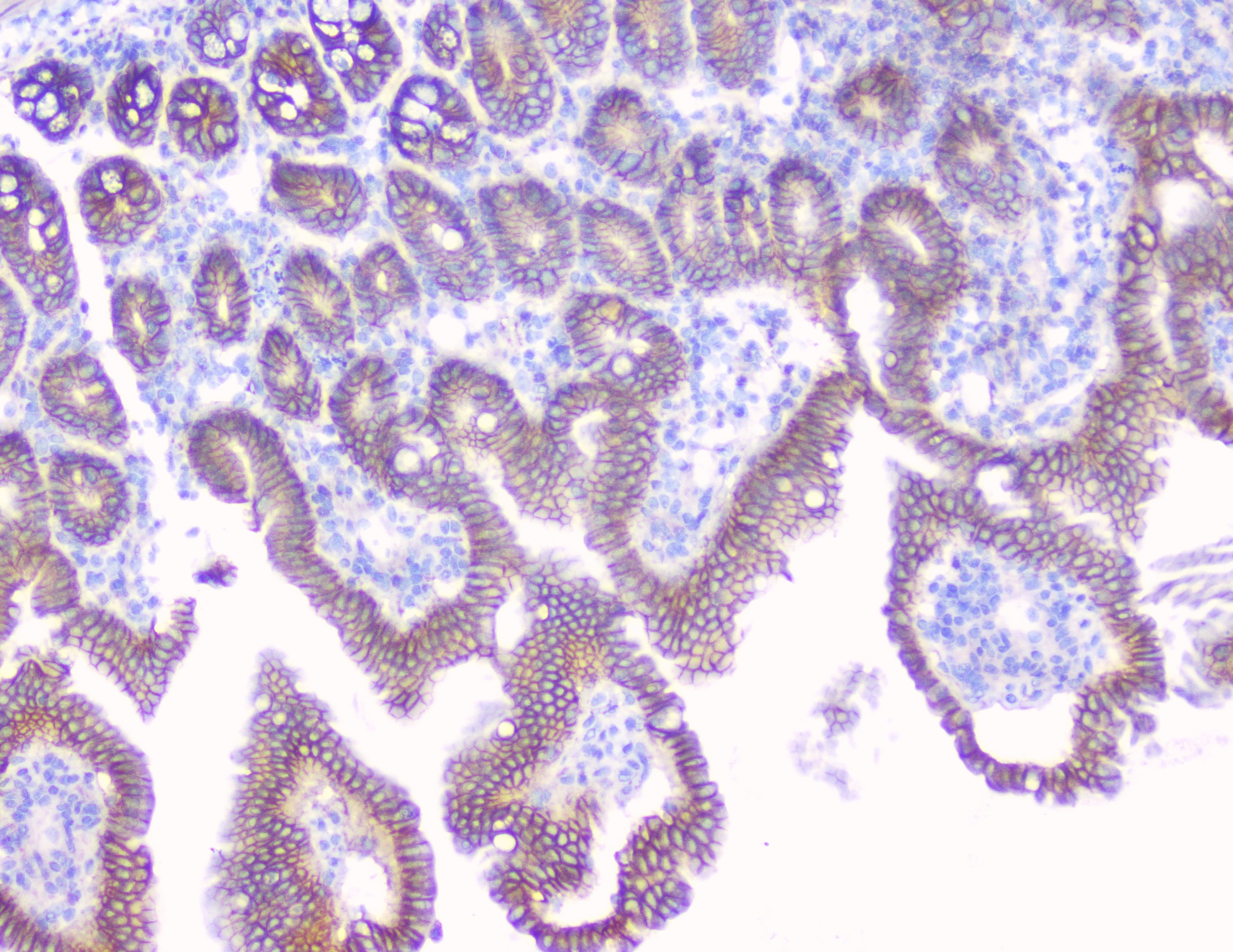 CTNNB1 / Beta Catenin Antibody