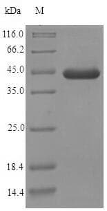 Mouse EFHD2 Protein (Recombinant 6His-SUMO, N-terminus)