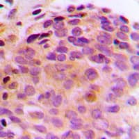 Polyclonal Rabbit anti-Human BAG4 / SODD Antibody (C-Terminus, IHC, WB)