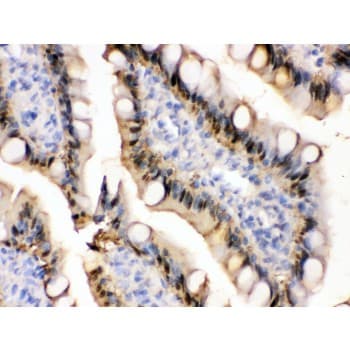 FABP1 / L-FABP Antibody (aa6-36)