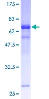 Human THOC3 Protein (Recombinant GST)