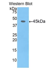 CDNF / ARMETL1 Antibody (aa33-187)
