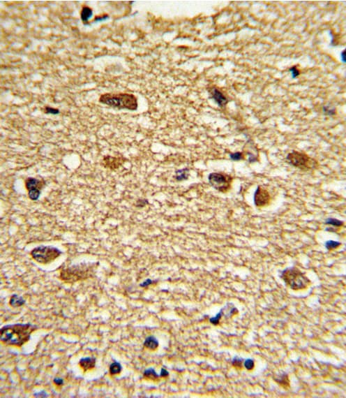 PEA3 / ETV4 Antibody (aa419-447)