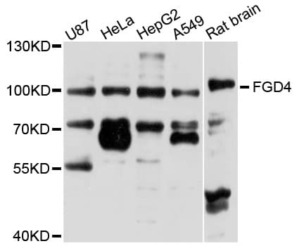 Polyclonal Rabbit anti-Human FGD4 Antibody (WB)