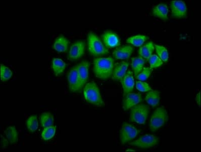 Spastic / GLRB Antibody
