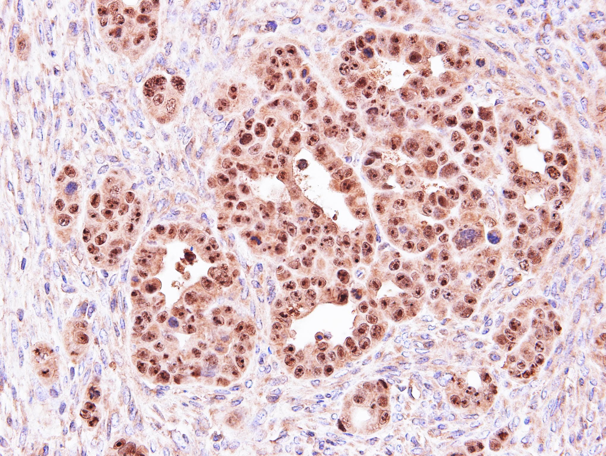 ALOXE3 Antibody (aa1-294)