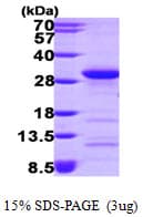 Human RHOA Protein (Recombinant His)
