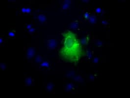 LIPG / Endothelial Lipase Antibody (clone OTI8F8)
