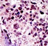 PRKAR1B Antibody (aa50-80)