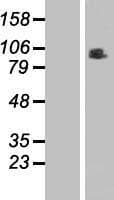 RINT1 Protein (Over-Expression Lysate Myc-DDK (Flag))
