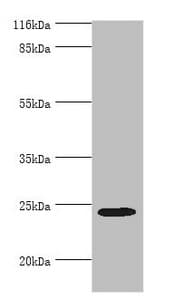 Polyclonal Rabbit anti-Human MIS12 Antibody (aa1-305, IHC, WB)