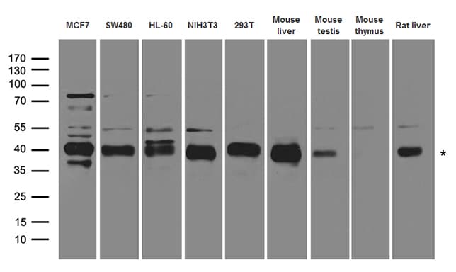 Polyclonal Rabbit anti-Human RFC3 Antibody (WB)