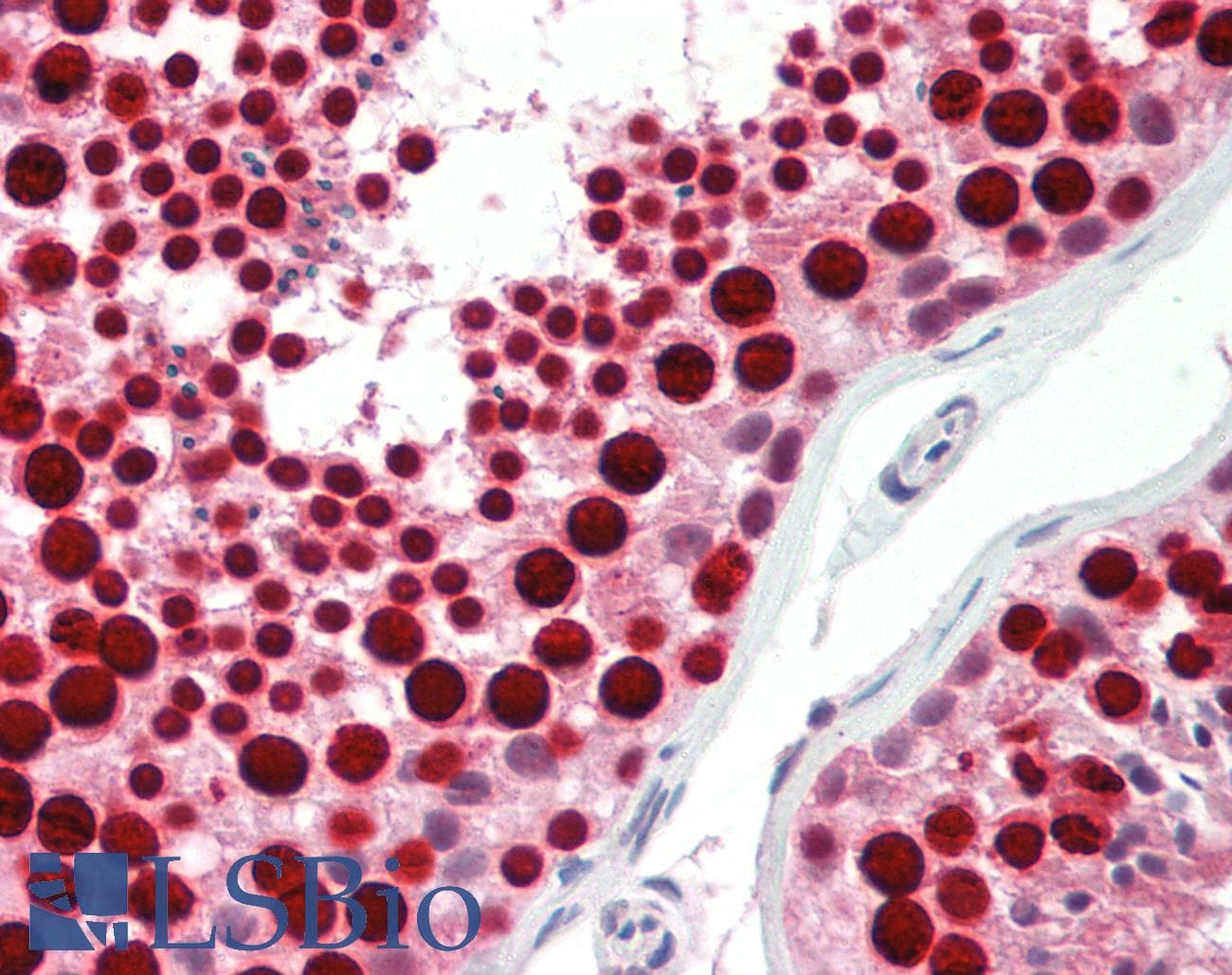 PathPlus™ TOP2A / Topoisomerase II Alpha Antibody