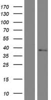 TMEM19 Protein (Over-Expression Lysate Myc-DDK (Flag))
