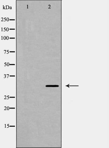 TNFSF10 / TRAIL Antibody