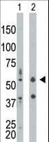 Polyclonal Rabbit anti-Human EIF2AK2 / PKR Antibody (aa11-42, IHC, WB)
