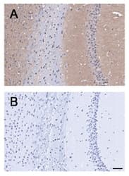 ADGRB1 / BAI1 Antibody (C-Terminus, Biotin)