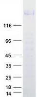 Human PTPRJ / CD148 Protein (Recombinant Myc-DDK (Flag))