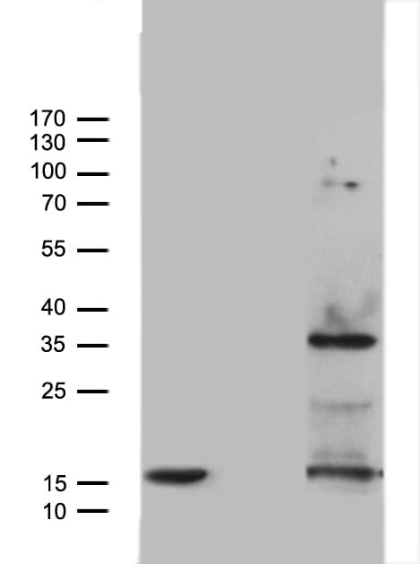 TNF Alpha Antibody (clone OTI5A11, Carrier-free)
