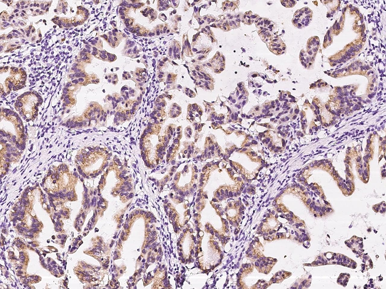 Polyclonal Rabbit anti-Human AGR2 Antibody (IHC)