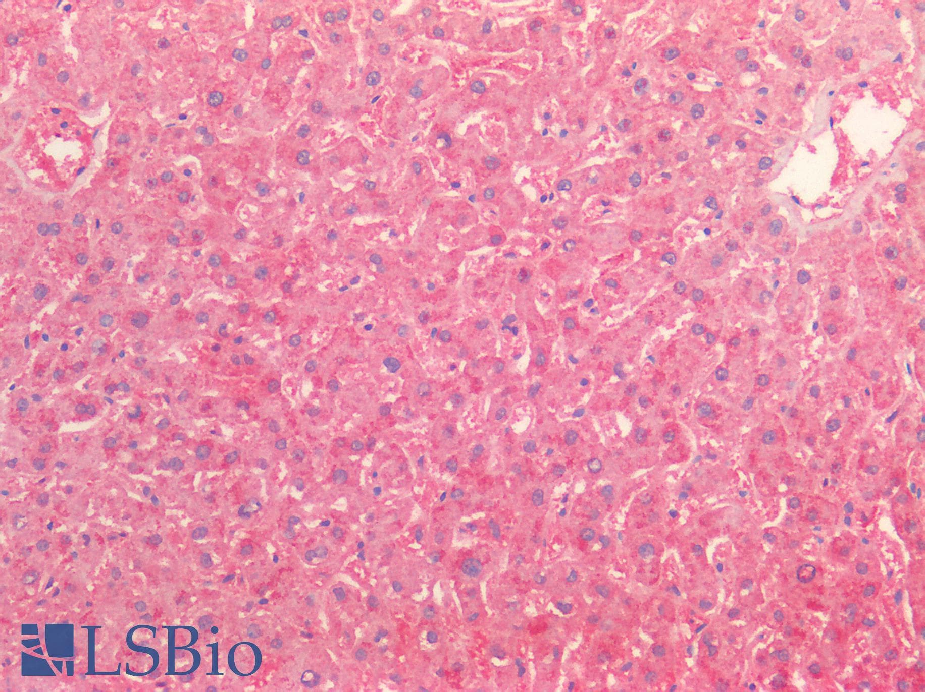 IHC-plus™ TNFRSF1B / TNFR2 Antibody (aa65-78)
