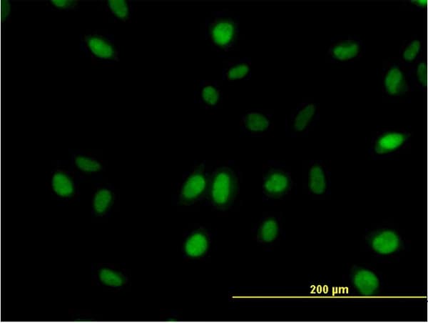 MED21 Antibody (clone 3E9)