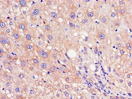 RHOE / RND3 Antibody