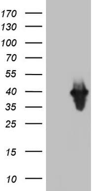 PCNA Antibody (clone OTI13G4)