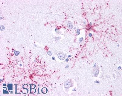 PathPlus™ CCR4 Antibody (C-Terminus)