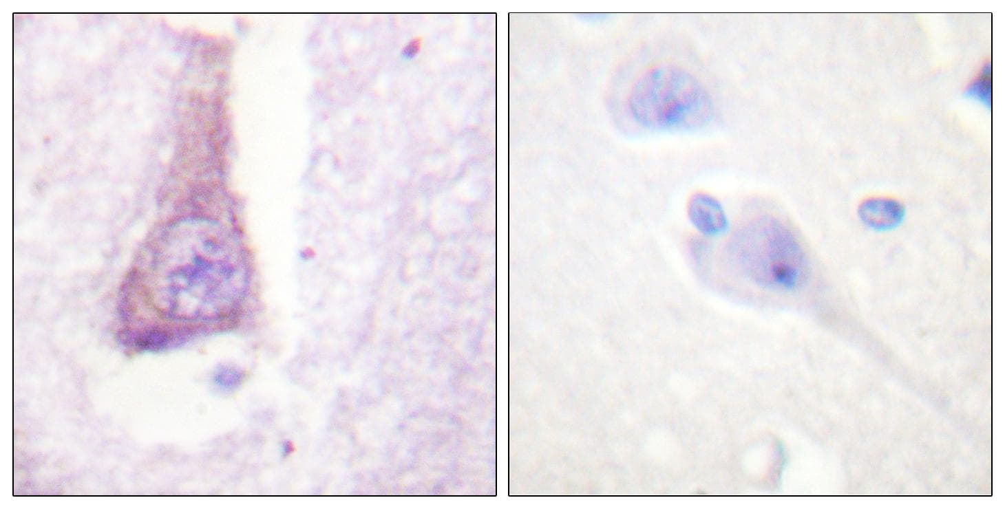 WAS / WASP Antibody (p290)