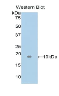 LTA / TNF Beta Antibody (aa49-202)